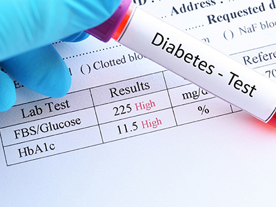 دیابت چگونه تشخیص داده می شود؟